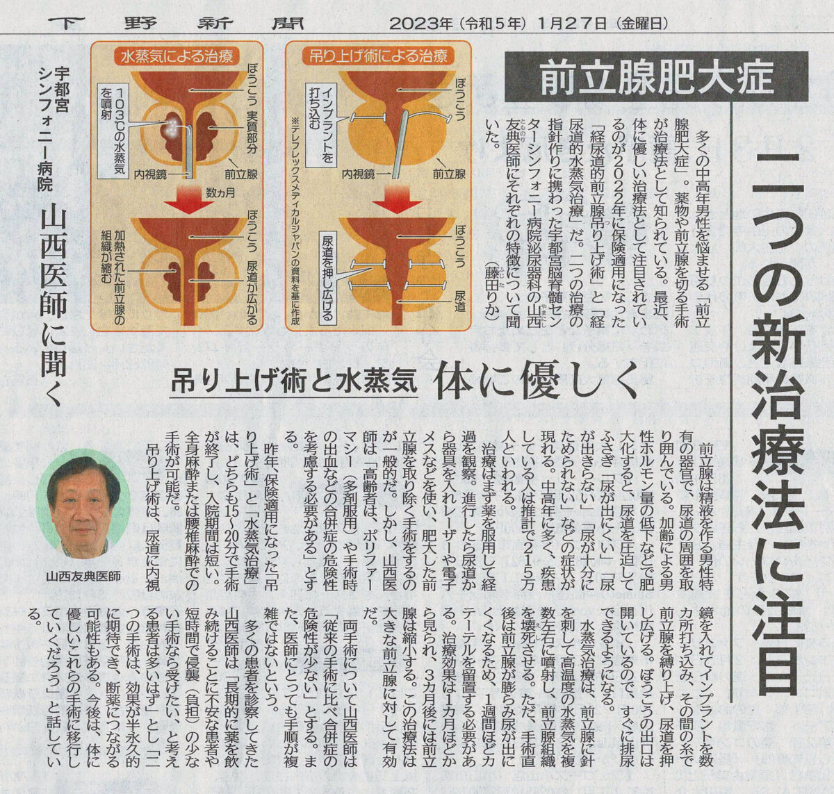 当院泌尿器科の山西医師が行っている前立腺肥大、排尿障害に対する